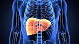 Semaglutide alleviates metabolic-linked liver disease in people with HIV