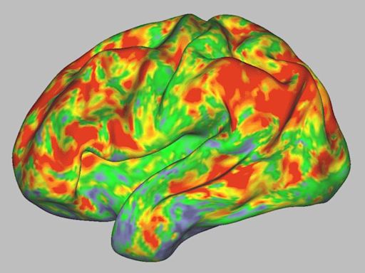 This is your brain on psilocybin