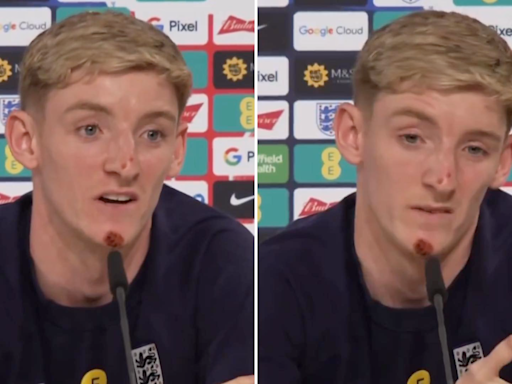 Anthony Gordon praised for showing the mentality 'no other England player has' during press conference