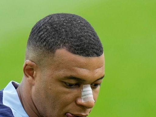 Euro 2024: Kylian Mbappe Trains With Injured Nose Ahead Of Netherlands Clash - News18