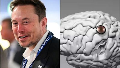 Neuralink volverá a implantar un chip cerebral: estos son los “superpoderes” que anunció Elon Musk - La Tercera