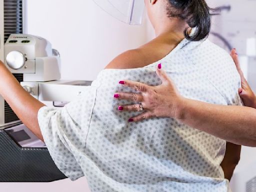 Breast cancer deaths in the US continue to fall, but new report warns of rise in cases among women younger than 50