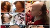 Girl, 7, lost her hair thanks to daily bullying and abuse at school