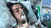 Rare condition left man 'unable to breathe or talk' for six weeks