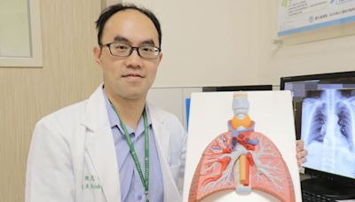 沒抽菸卻咳到懷疑人生！ 她檢查「氣管塞滿痰」全怪1疾病