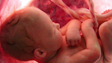 Avances en medicina reproductiva: la inteligencia artificial podría revolucionar los tratamientos de fertilidad
