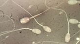 Microplastics Found In Human Testicles – And May Be Impacting Sperm