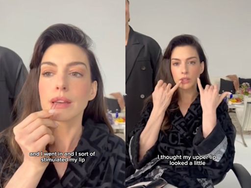 Anne Hathaway’s savvy use of hair pins to plump lips goes viral