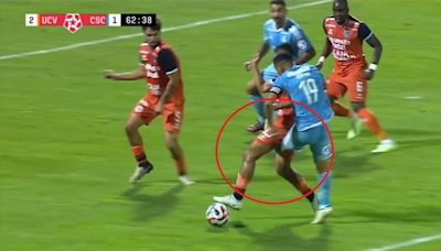 "Se partió la pierna": La escalofriante lesión que sufrió ídolo peruano en pleno partido