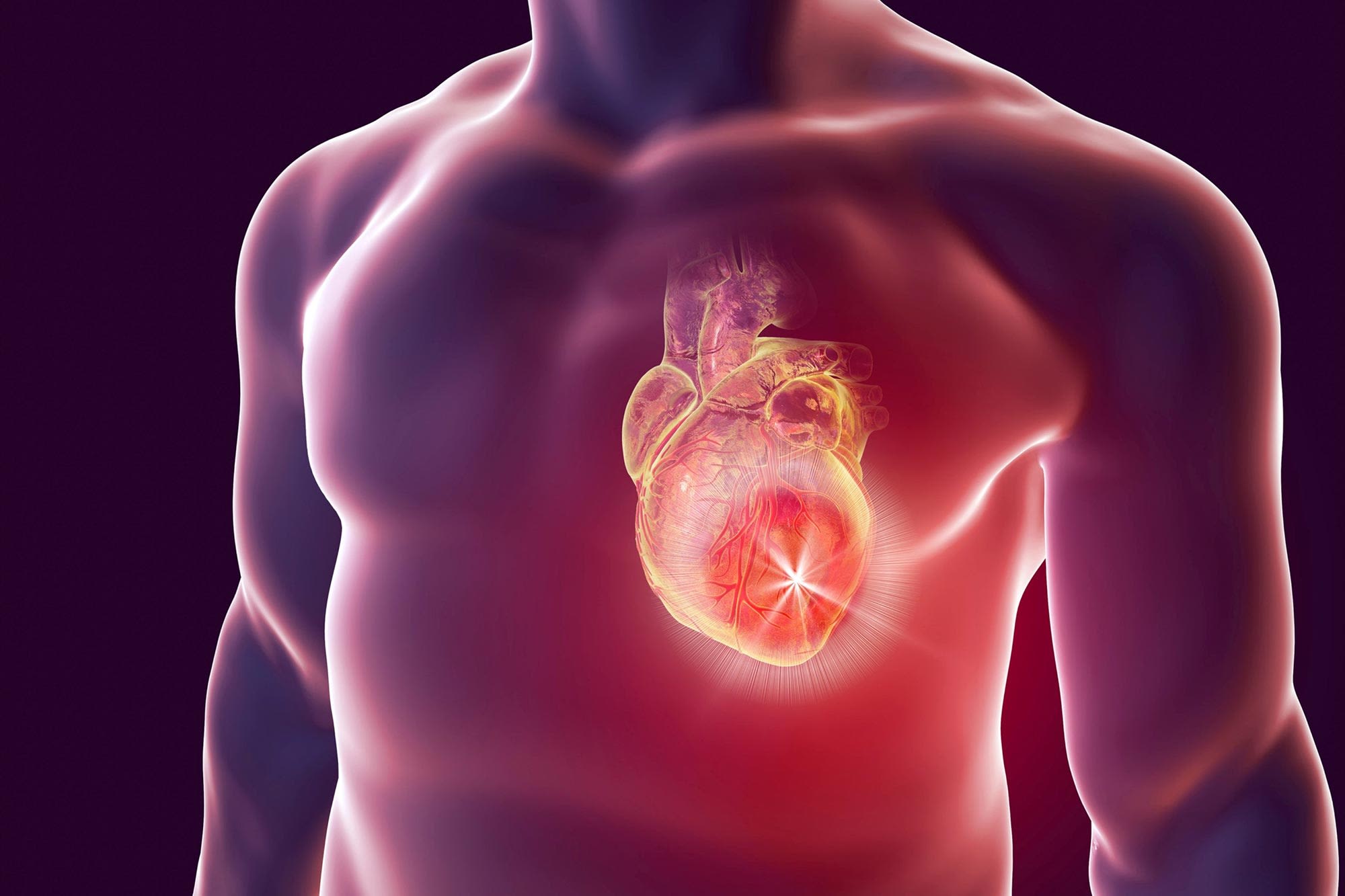 Concerning Findings – This Severe Heart Disease Is Becoming Much More Common