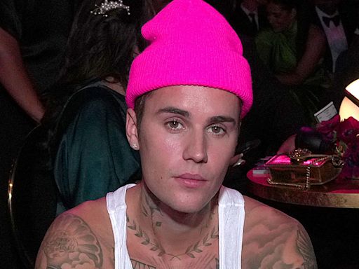 Justin Bieber shows off his facial mobility after Ramsay Hunt syndrome diagnosis left his face partially paralyzed