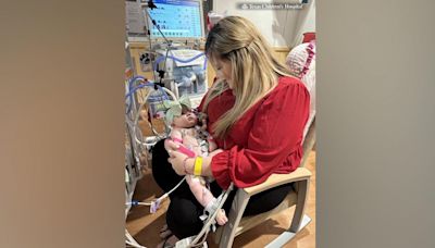 Infant takes 1st breaths on her own after undergoing rare double lung transplant