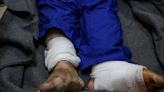 Action must be taken on alleged complicity of Israeli doctors in torture