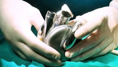 Titanium Heart Implant: Milestone In Medical Science