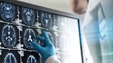 AI is fueling transformative new brain-health technology to detect and prevent cognitive decline