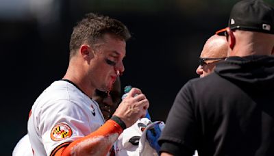 Orioles' James McCann stays in game after taking fastball to his face