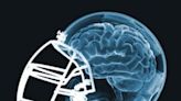 Return to activity, limiting screen time good after concussions, new study says