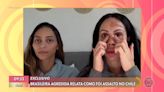 Brasileira agredida em assalto no Chile fala com exclusividade ao Encontro sobre violência sofrida e mostra hematomas