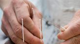 Persistent pain? Needles can help relieve the discomfort