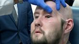 World's first whole-eye transplant hailed as breakthrough - but sight not yet restored