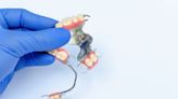 你適合戴活動假牙還是植牙？12個項狀況符合6項，要先請牙醫師評估