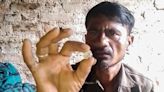 Un trabajador indio endeudado encuentra un diamante de US$ 100.000 que le cambiará la vida