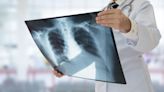 Rad AI, One Of The Fastest Growing Radiology Tech Companies, Secures $50 Million From Khosla Ventures