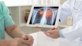 Genprex dosing subjects in trial of combination therapy for small-cell lung cancer