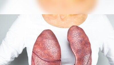 Most lung cancer patients in India are non-smokers, study reveals