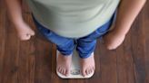 New study says teens with severe obesity can benefit from weight loss surgery