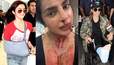 Priyanka Chopra Jonas, Alia Bhatt, Kangana Ranaut and other Bollywood divas who got injured on set