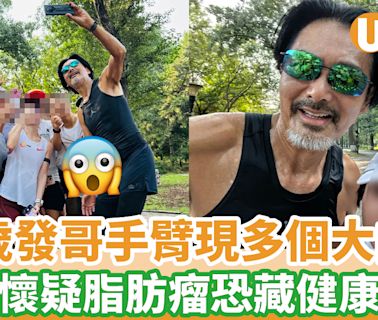 69歲周潤發手臂驚現多個大肉粒 網民懷疑脂肪瘤恐藏健康隱憂 | U Food 香港餐廳及飲食資訊優惠網站