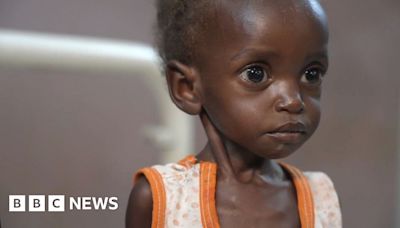 Sudan war: Inside a hospital on the front line of a hunger crisis