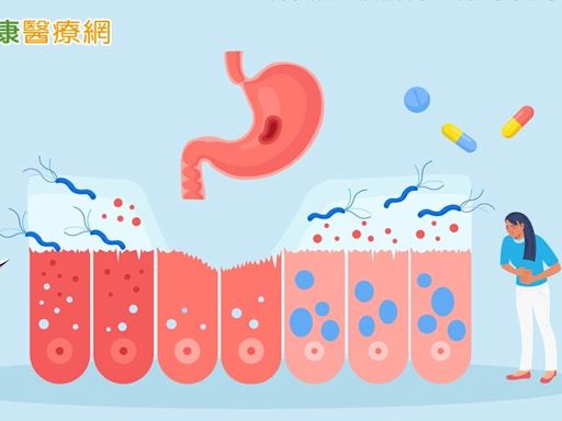 力拚2030年降低1/3癌症死亡率！國健署研擬幽門螺旋桿菌檢測 最快8月開始試辦