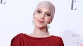 Muere Elena Huelva, la joven española de 20 años que visibilizó en redes su batalla con el cáncer