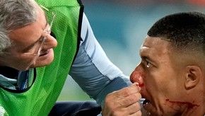 Los mejores memes tras la lesión de Mbappé y la máscara que usará en la Euro