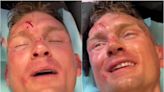 Video: Stephen Thompson gets stitched up in aftermath of UFC on ESPN 42 battle