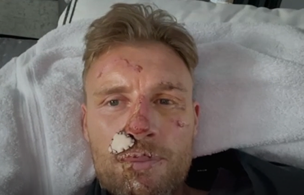 Freddie Flintoff films emotional hospital moment days after Top Gear crash