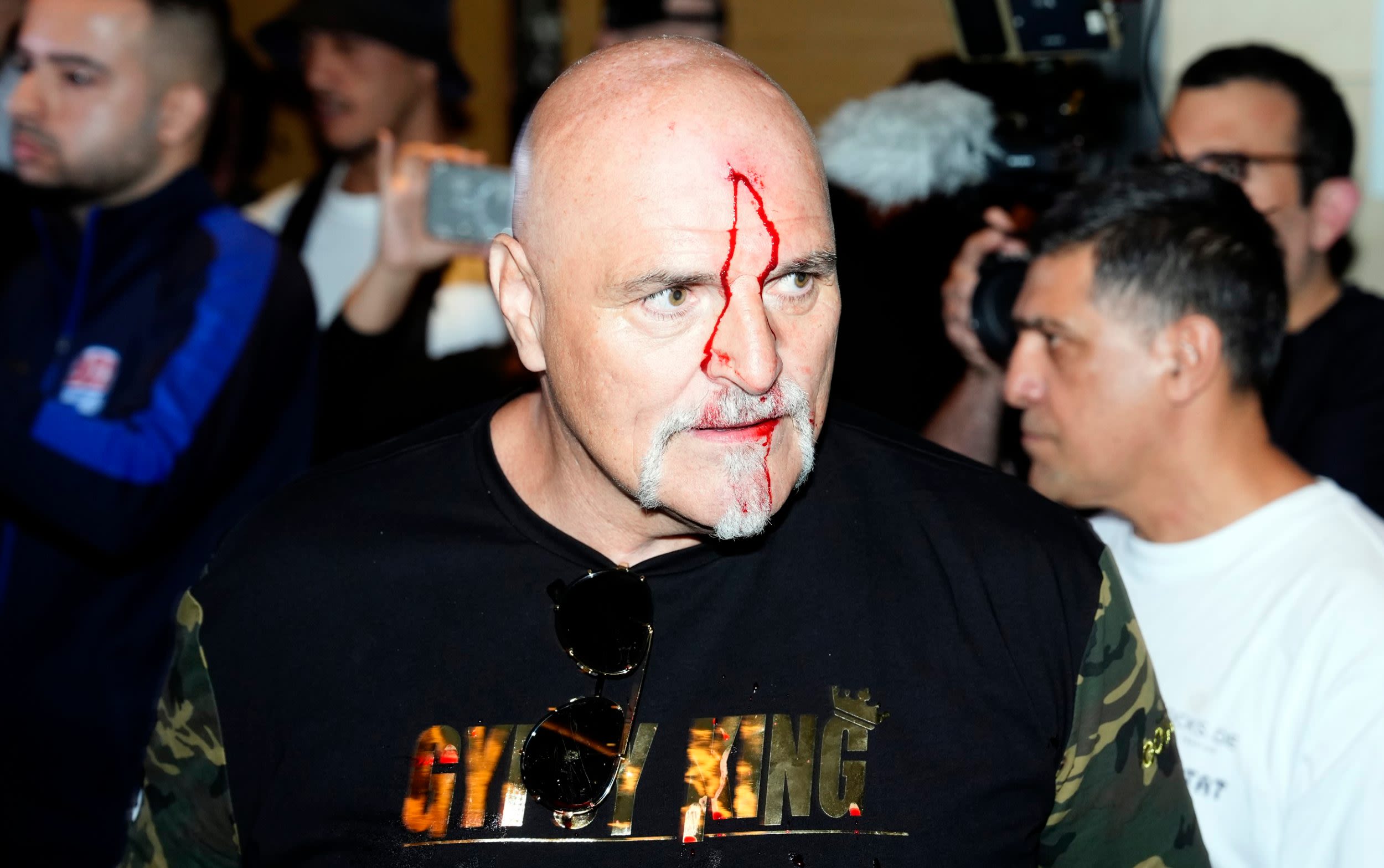 Watch: John Fury left bleeding after clash with Usyk’s team ahead of son Tyson’s unification fight