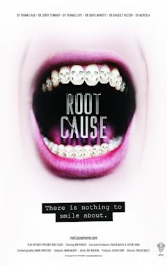 Root Cause