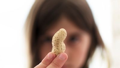 Should schools ban peanuts? What to know as Quebec group calls for end to allergen bans in school