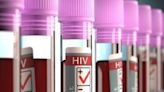 Twice-a-Year Injection Gives Women Full Protection Against HIV, Trial Finds | Fox 11 Tri Cities Fox 41 Yakima