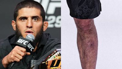 Islam Makhachev addresses speculation of a Staph infection ahead of UFC 302 | BJPenn.com