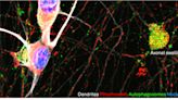 Study finds that the transport of mRNAs into axons along with lysosomal vesicles prevents axon degeneration