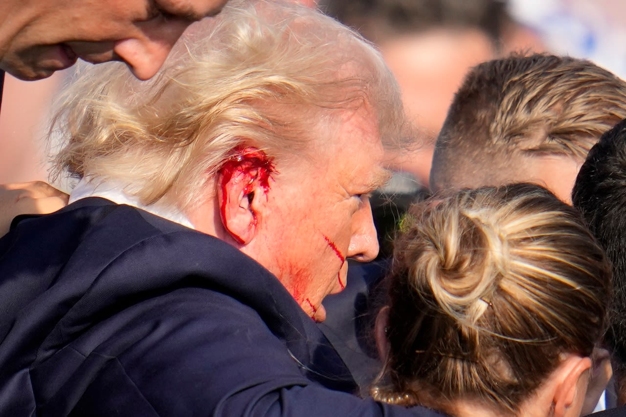 Trump’s ear was struck by bullet in assassination attempt, FBI confirms