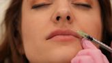 Skin Check-In With Dr. Will: Why ‘Lip Flip’ Filler Treatment Is ‘So Wildly Popular During the Holidays’