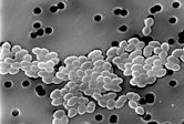 Vancomycin-resistant Enterococcus