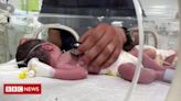 Guerra Israel-Hamas: a bebê de Gaza retirada viva do ventre da mãe morta após ataque