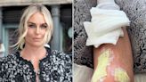 Lindsey Vonn Reveals She’s Preparing to Undergo Knee Replacement Surgery