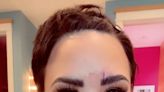 Demi Lovato Explains How They Injured Their Face on a Crystal: 'I Had to Get 3 Stitches!'